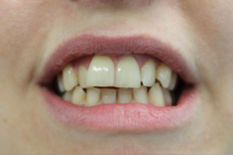 Before - Cheadle Hulme Dental