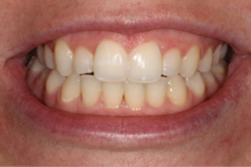 After - Cheadle Hulme Dental