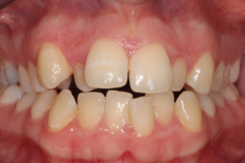 Before - Cheadle Hulme Dental