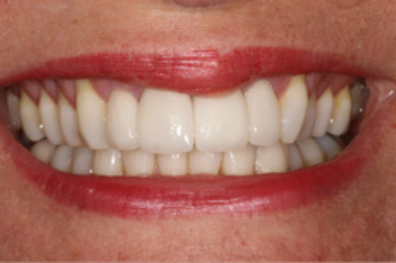 After - Cheadle Hulme Dental