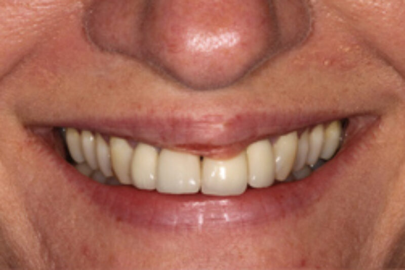 Before - Cheadle Hulme Dental