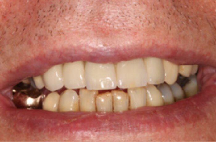 After - Cheadle Hulme Dental