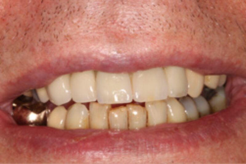 After - Cheadle Hulme Dental