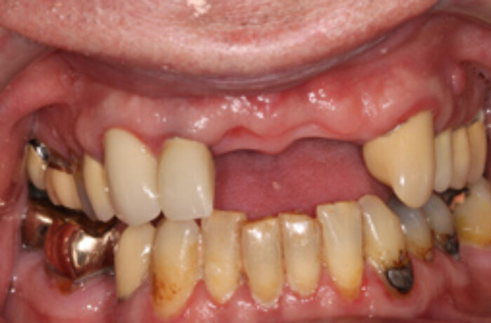 Before - Cheadle Hulme Dental