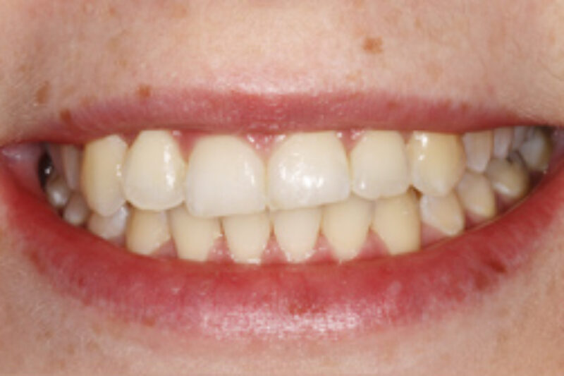 After - Cheadle Hulme Dental