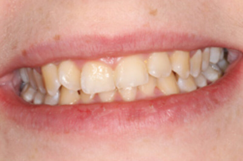 Before - Cheadle Hulme Dental