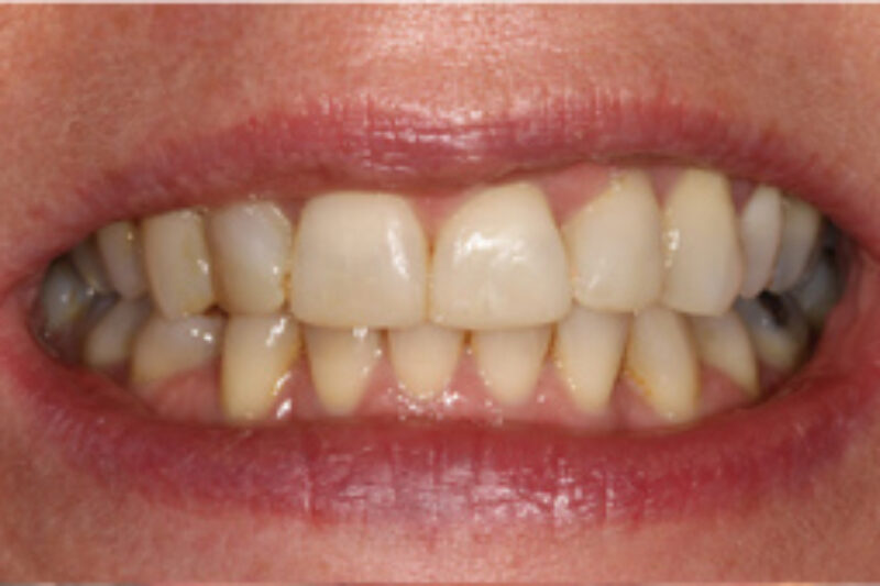 After - Cheadle Hulme Dental