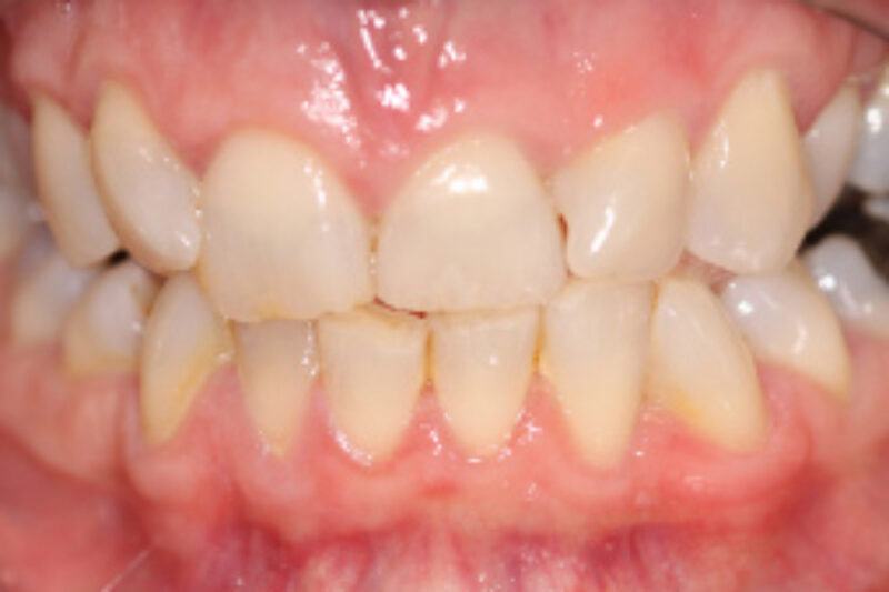 Before - Cheadle Hulme Dental