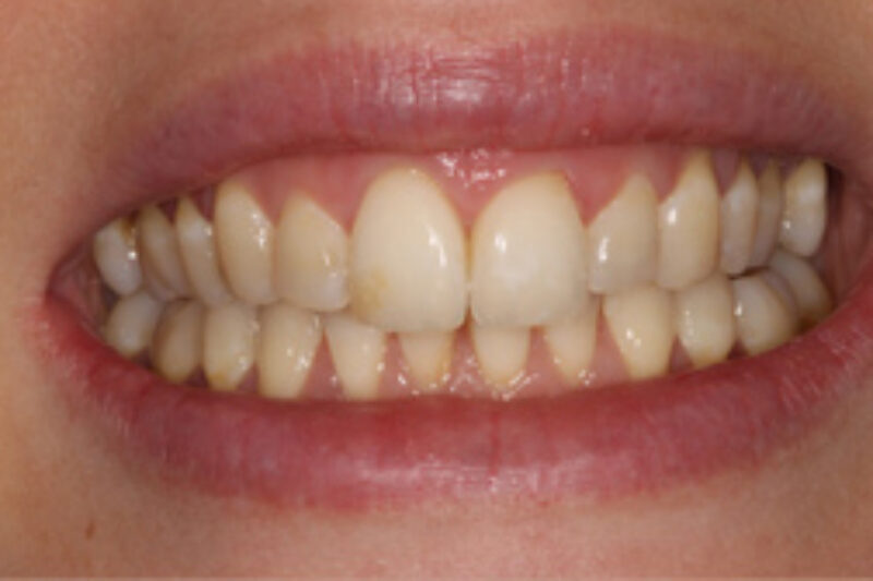 After - Cheadle Hulme Dental