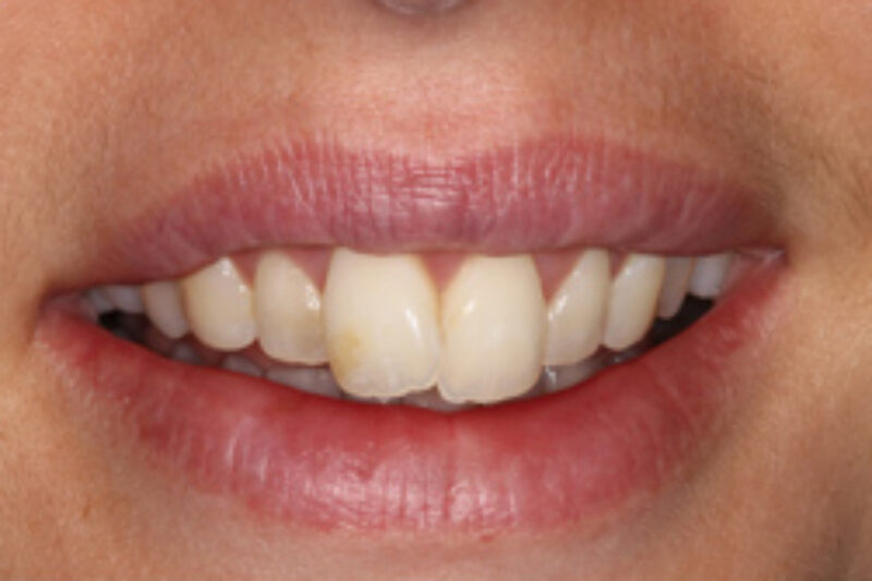 Before - Cheadle Hulme Dental