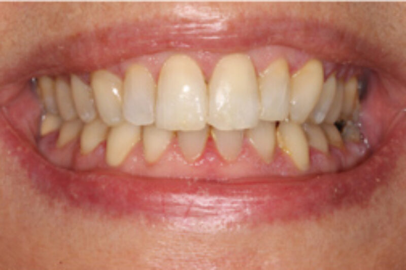 After - Cheadle Hulme Dental