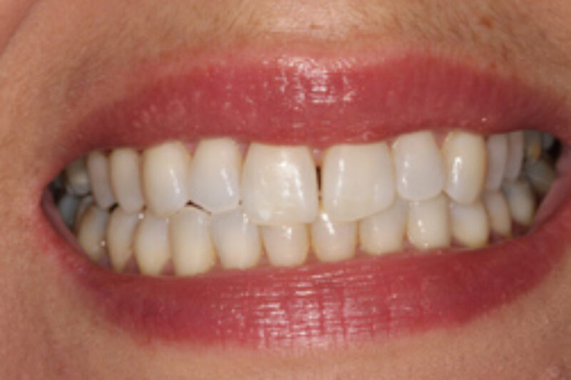 After - Cheadle Hulme Dental