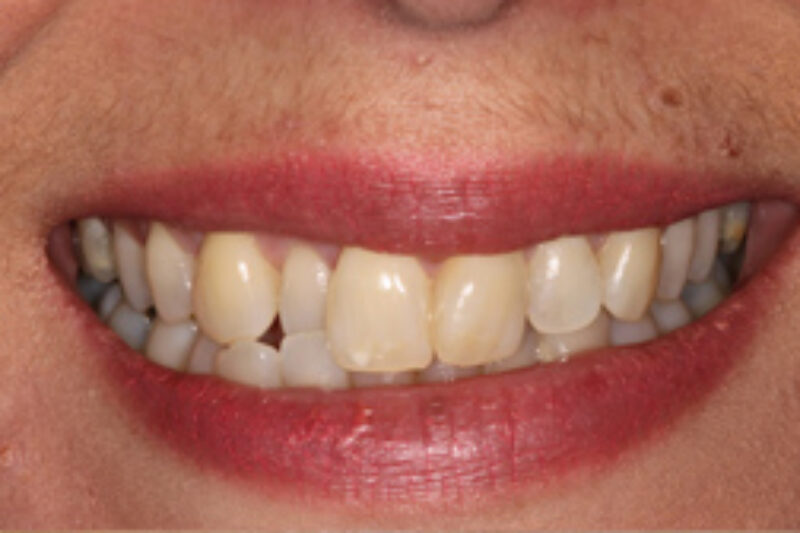 Before - Cheadle Hulme Dental