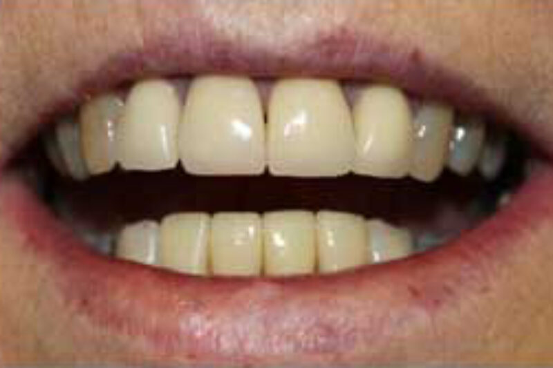 After - Cheadle Hulme Dental