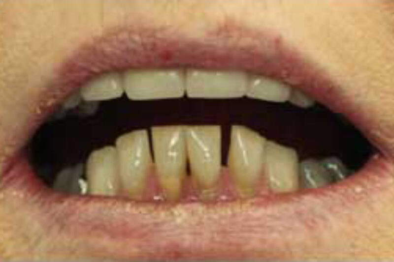 Before - Cheadle Hulme Dental