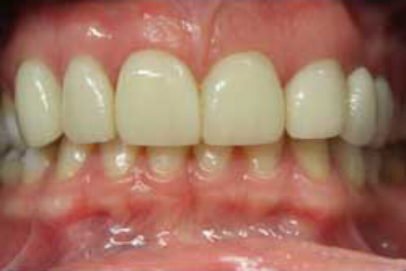 After - Cheadle Hulme Dental