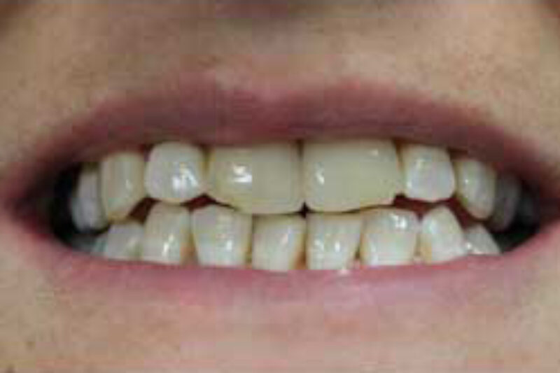 Before - Cheadle Hulme Dental