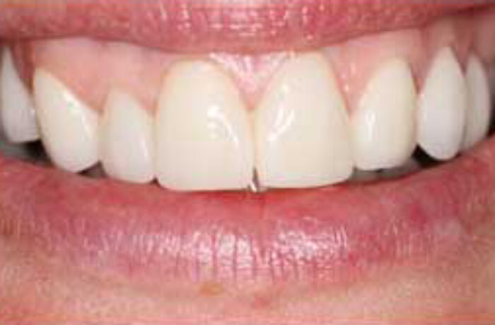 After - Cheadle Hulme Dental