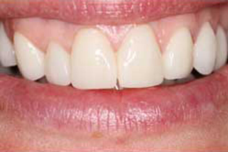 After - Cheadle Hulme Dental