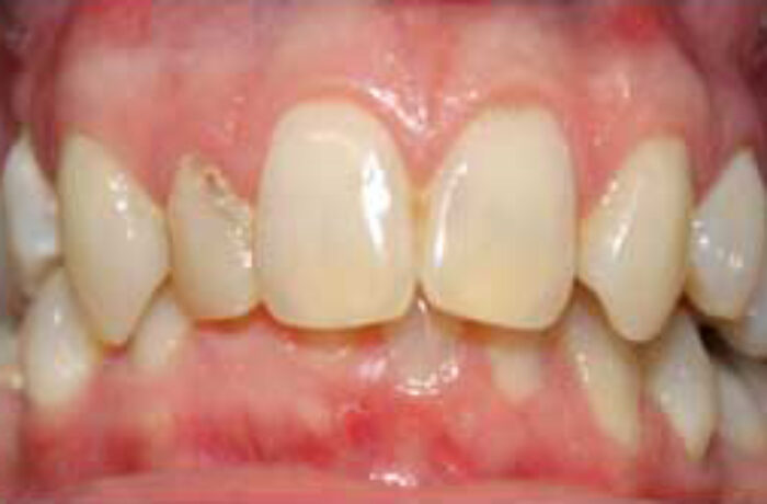 Before - Cheadle Hulme Dental