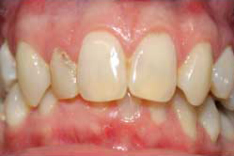 Before - Cheadle Hulme Dental