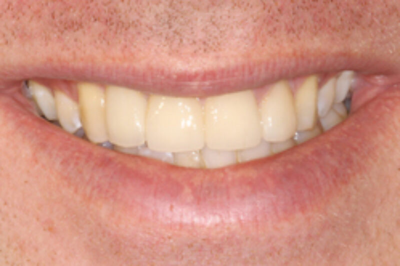 After - Cheadle Hulme Dental