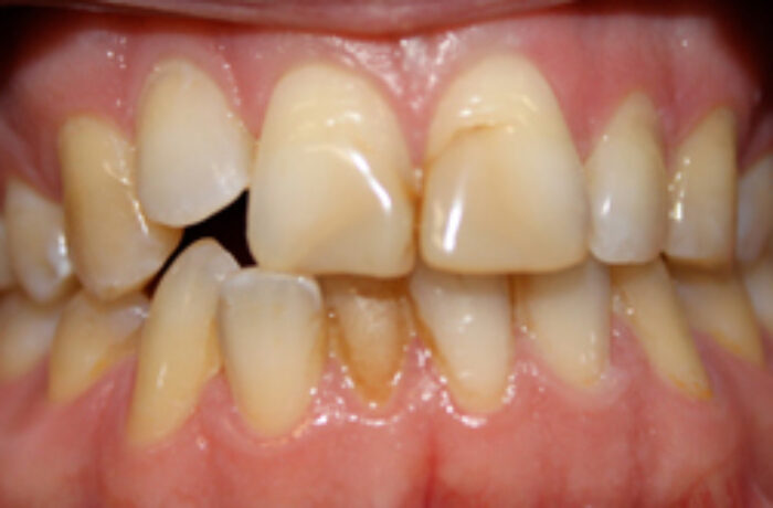 Before - Cheadle Hulme Dental