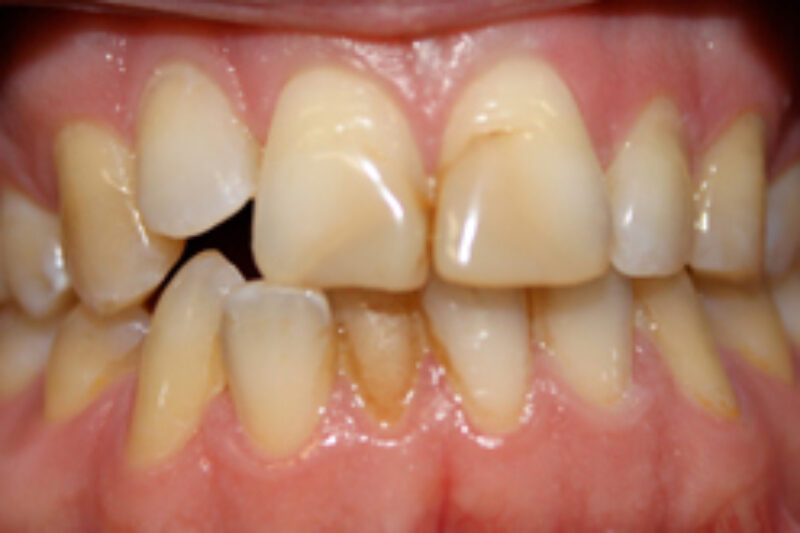 Before - Cheadle Hulme Dental