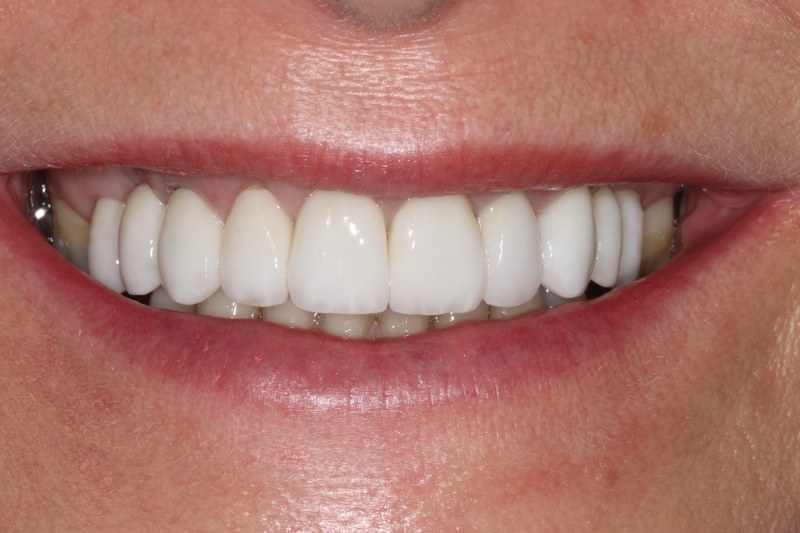 After - Cheadle Hulme Dental