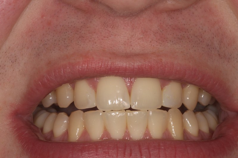 After - Cheadle Hulme Dental