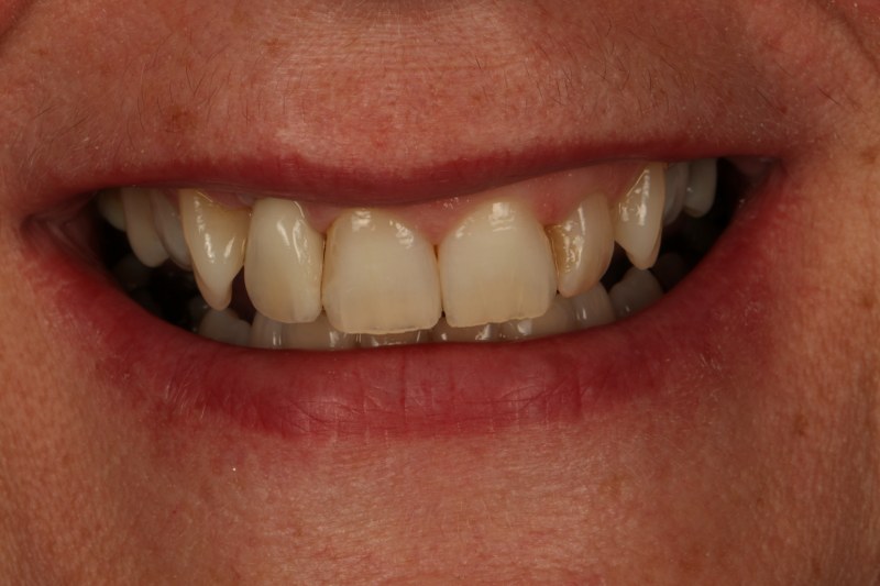 After - Cheadle Hulme Dental