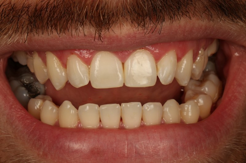 After - Cheadle Hulme Dental