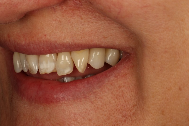 After - Cheadle Hulme Dental