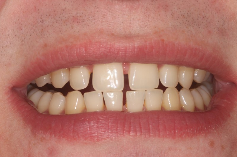 Before - Cheadle Hulme Dental