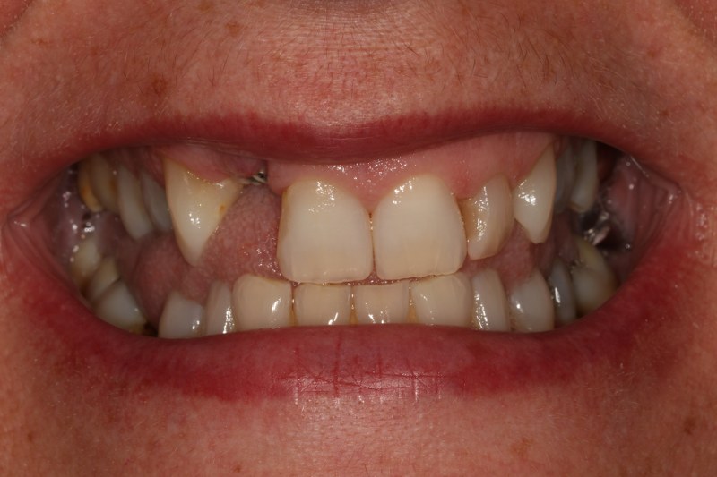 Before - Cheadle Hulme Dental