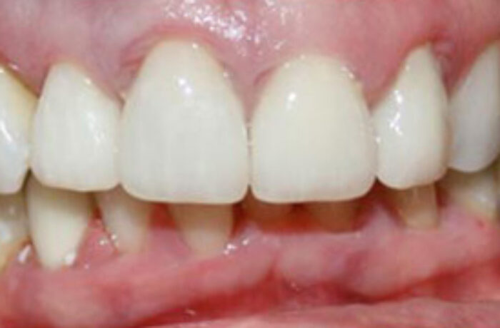 After - Cheadle Hulme Dental