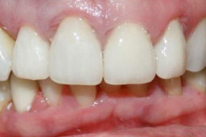 After - Cheadle Hulme Dental