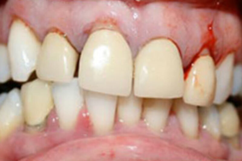 Before - Cheadle Hulme Dental