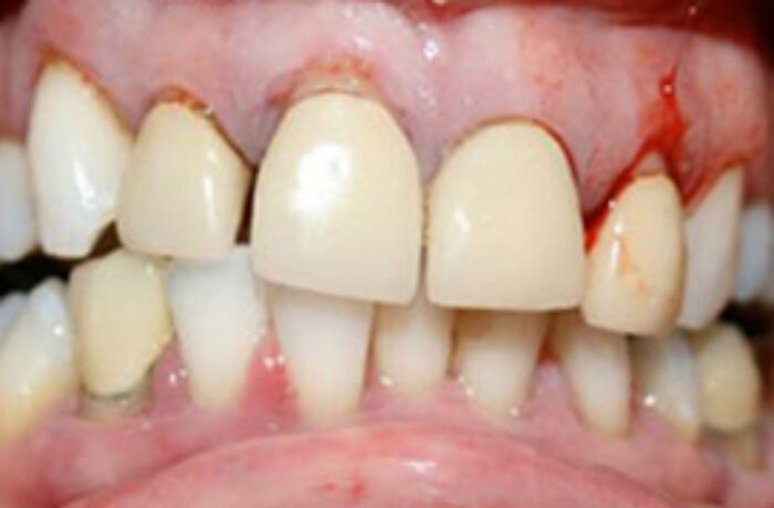 Before - Cheadle Hulme Dental