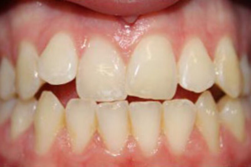 Before - Cheadle Hulme Dental