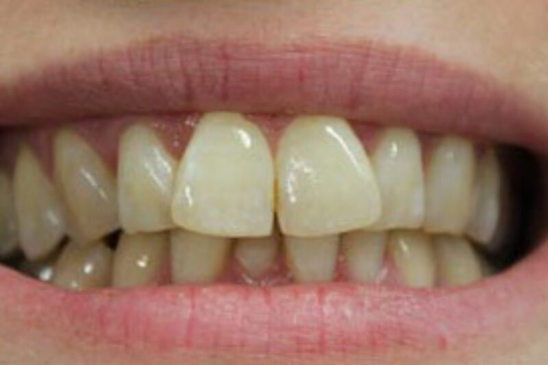 Before - Cheadle Hulme Dental