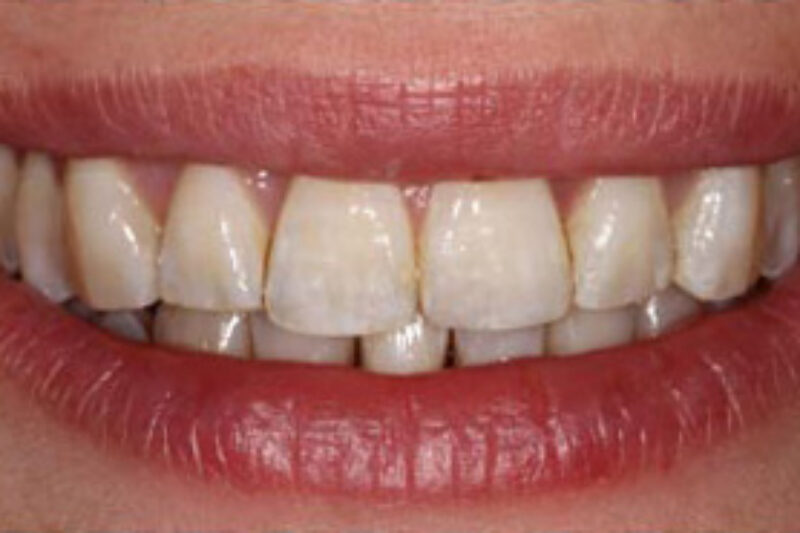 After - Cheadle Hulme Dental