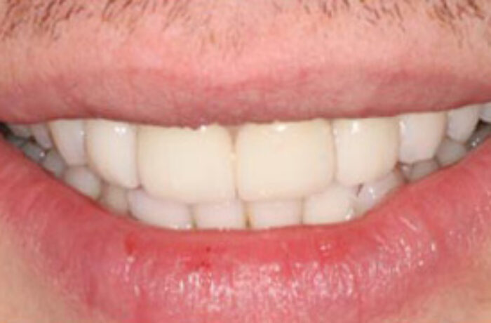 After - Cheadle Hulme Dental