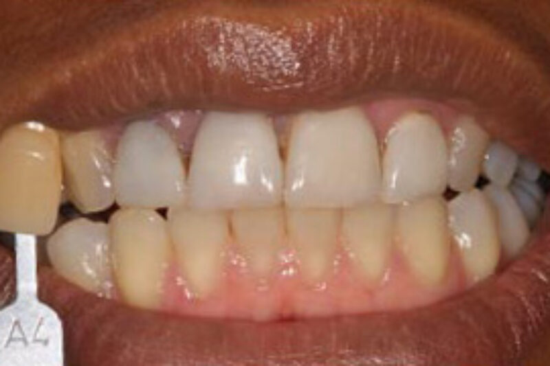 Before - Cheadle Hulme Dental