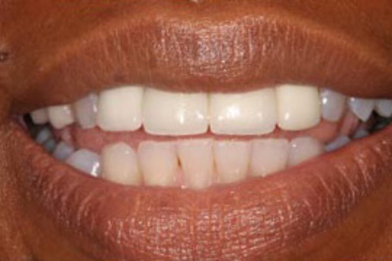 After - Cheadle Hulme Dental