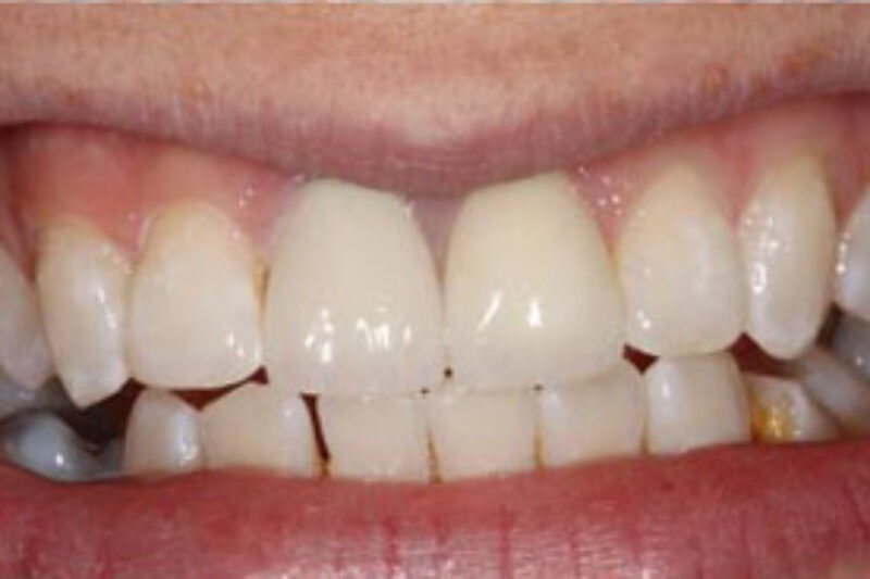 After - Cheadle Hulme Dental