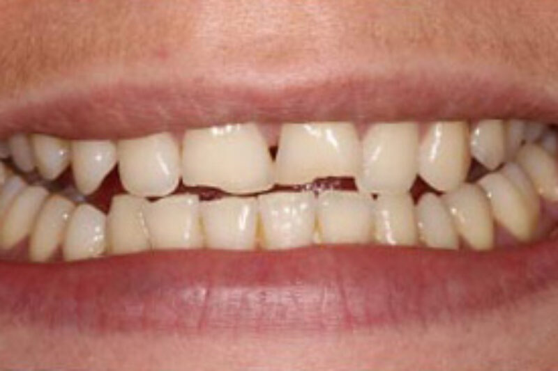 Before - Cheadle Hulme Dental