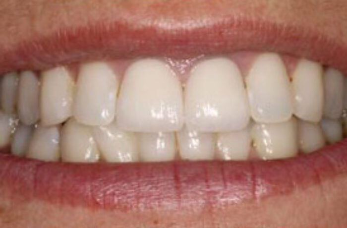 After - Cheadle Hulme Dental