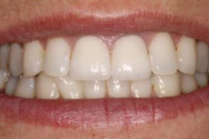 After - Cheadle Hulme Dental