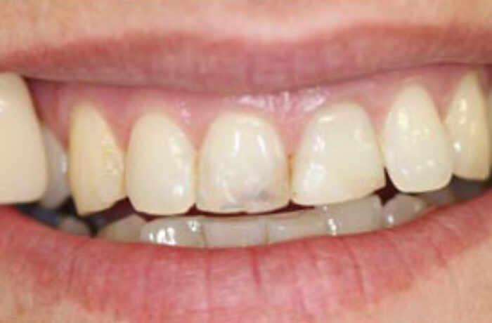 Before - Cheadle Hulme Dental